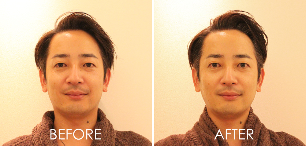 14_before_after